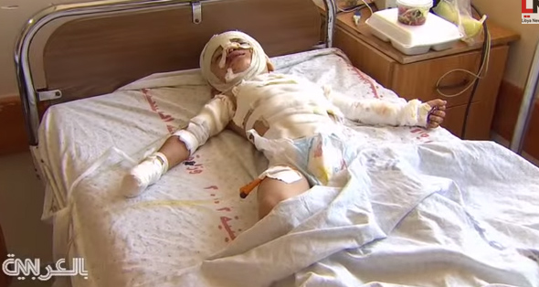 “بابا خليك”.. رجاء من طفل جريح في غزة