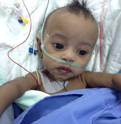 نجاح أول عملية قلب مفتوح لطفلة في مستشفى خالد بنجران