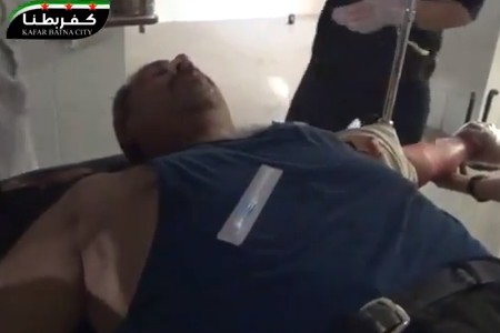 بالفيديو.. بكاء طفل سوري متأثراً بجراحه