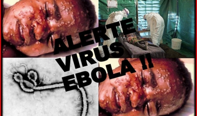 رصد أول إصابة بوباء إيبولا بالولايات المتحدة