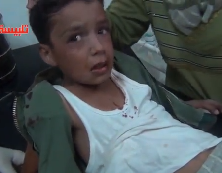 بالفيديو.. طفل سوري مصاب: “ماما لا تخافي هذا دم بشار”