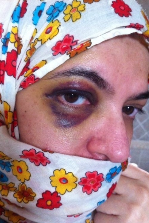 بالصور.. “سعودية” تتعرض للضرب من شقيقها في نهار رمضان