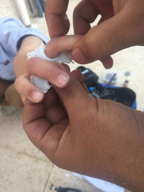 إنقاذ أصابع طفل علقت بكريي بلاستك بسيهات ‫(248391985)‬ ‫‬