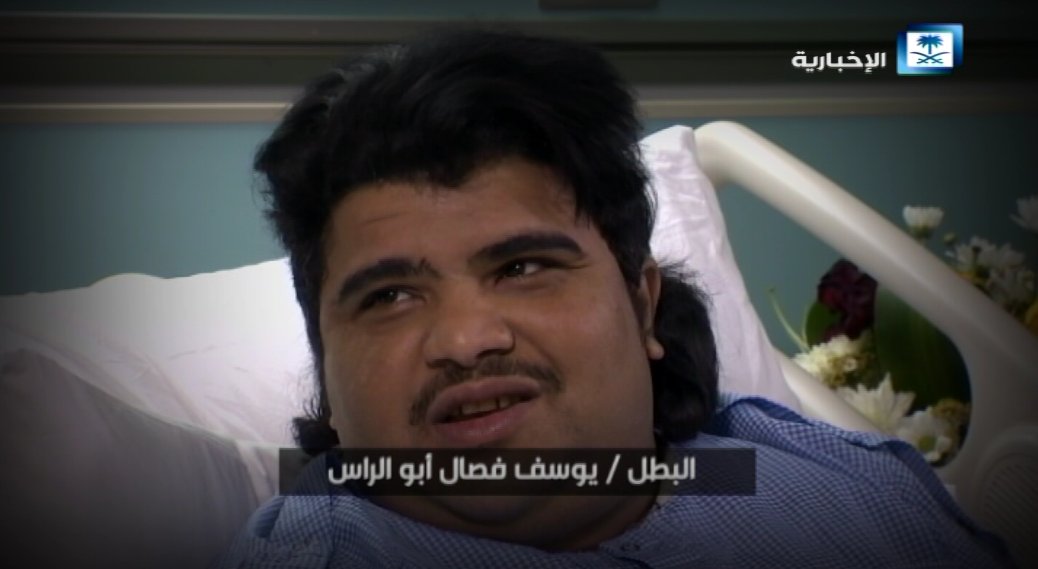 يوسف أبو الراس: مقذوف الحوثي بتر رجلي.. وأتمنى العودة لمواجهتهم