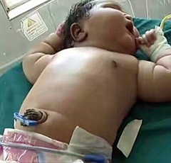 ولادة الطفلة الأثقل في العالم.. 9 كيلو جرام ووالدتها 19 عامًا