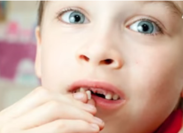 بالفيديو.. طريقة الحفاظ على الأسنان الدائمة لدى الأطفال