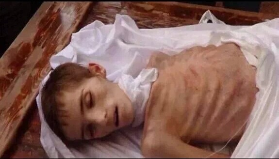 اطفا سوريا يموتون جوعا (1)