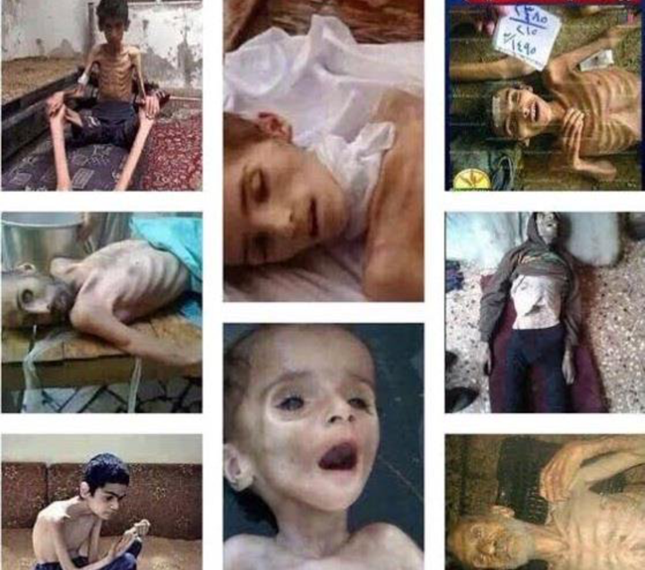 أنقذوهم.. 50 ألف سوري في #مضايا يموتون جوعاً