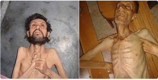 اطفا سوريا يموتون جوعا (4)