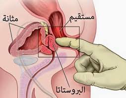 التهاب البروستاتا وهاجس الفحولة لدى الرجال