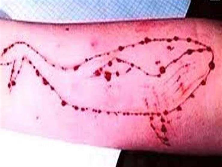 ضحية خامسة من ضحايا لعبة الحوت الأزرق في مصر