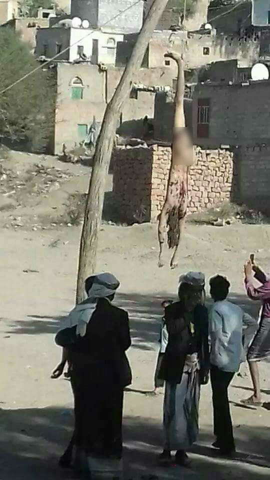 صور مؤلمة.. الحوثيون يعذبون رجلًا ثم يعدمونه!