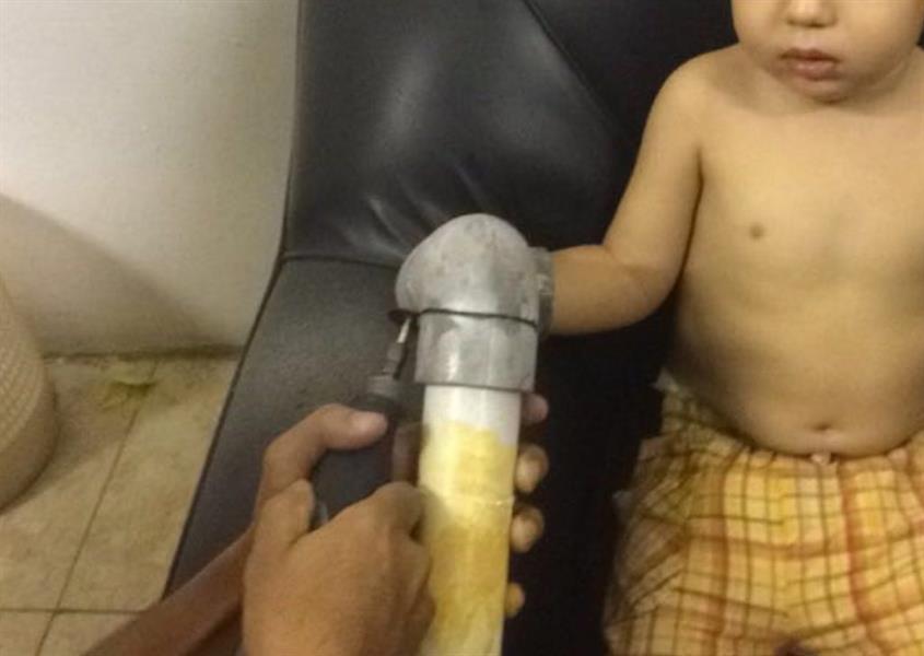 بالصور.. مدني جدة يُحرر يد طفل علقت داخل ماسورة