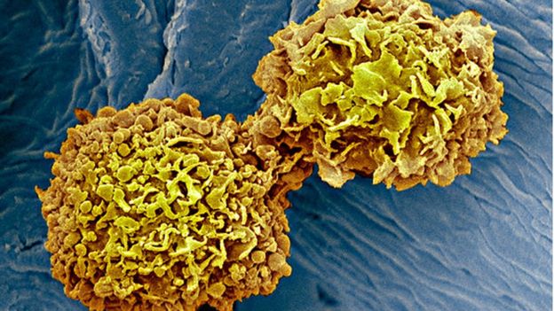 اكتشاف علمي يقضي على المواد المسببة للسرطان