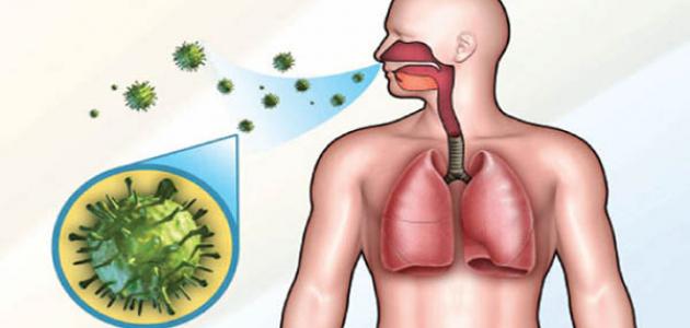 مرض السل .. طرق الوقاية ونصائح للمرضى