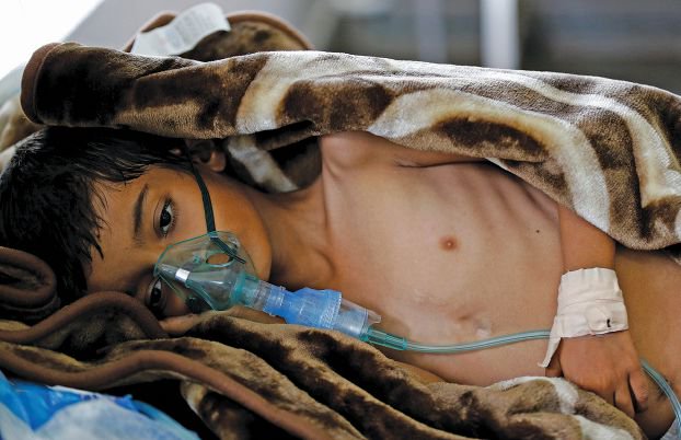 في اليمن.. نسبة الشفاء من وباء الكوليرا 99.5% والوفيات تصل 0.2%