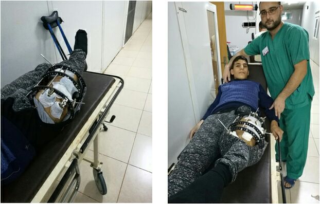 المهمة الطبية 11 لعلاج الجرحى السوريين لمبادرة نلبي النداء السعودية (1)