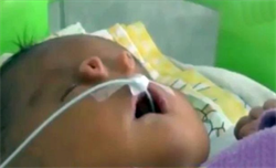 بالفيديو: طفل يولد بأنبوبان بدل الأنف