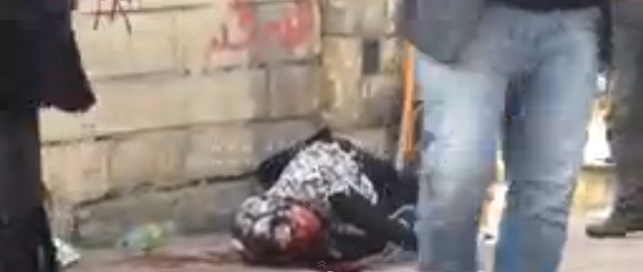 بالفيديو.. إنقاذ طالبة أصيبت بطلقات في رأسها بجامعة الأزهر