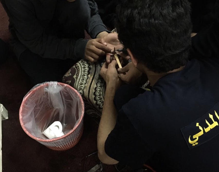 بالصور .. تحرير أصبع شاب من خاتم حديدي في #رفحاء