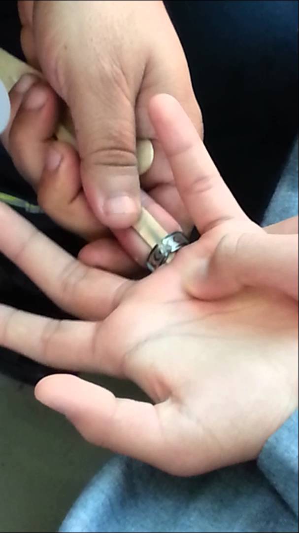 تحرير إصبع مواطنة من خاتم علق بها في جدة