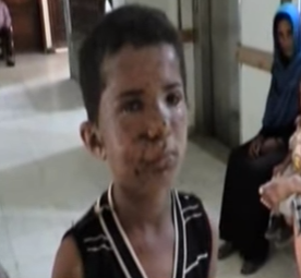 بالفيديو .. رصاص الإنقلابيون يقتل براءة أطفال تعز في رمضان