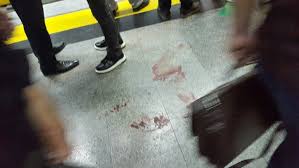 بالصور.. 15 مصاباً جراء هجوم بسكين في محطة مترو بطهران