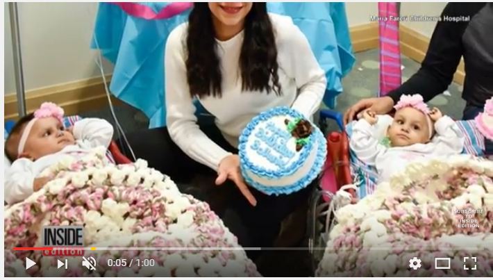 بالفيديو.. توأم ملتصق يحتفل بذكرى ميلادهما الأول بعد الفصل