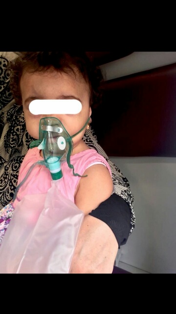 بالصور.. اختناق 5 أشخاص بينهم امرأة وطفلة بحريق شقة في #الدمام