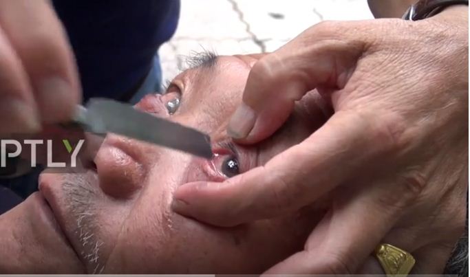فيديو مرعب.. حلاق ينظف عيون زبائنه بالسكين