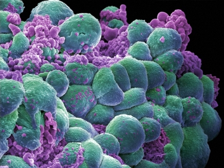 علماء يطورون فيروسًا اصطناعيًا للقضاء على السرطان