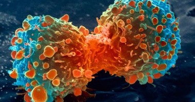 دراسة: 20% من السرطانات يمكن تجنبها باتباع أسلوب حياة صحي