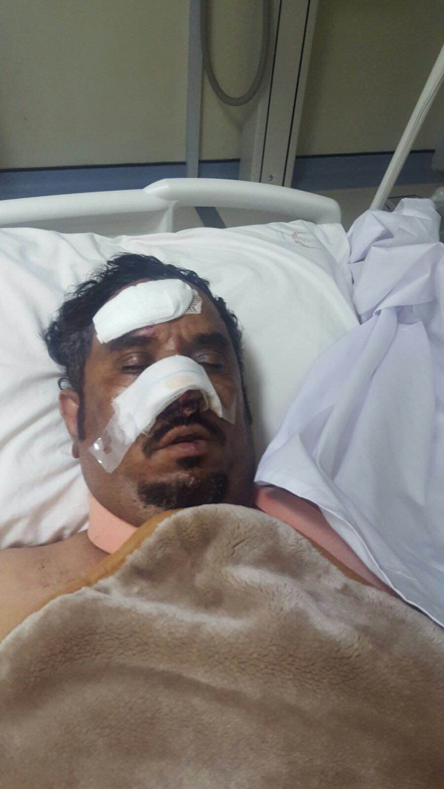 إصابة رئيس بلدية وادي الحياة بتهامة قحطان في حادث مروري