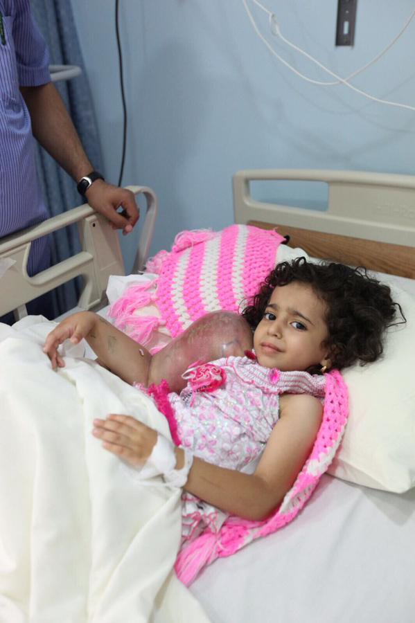 بالصور.. الطفلة #ريتاج وشقيقتها تصلان مستشفى #الحرس_الوطني