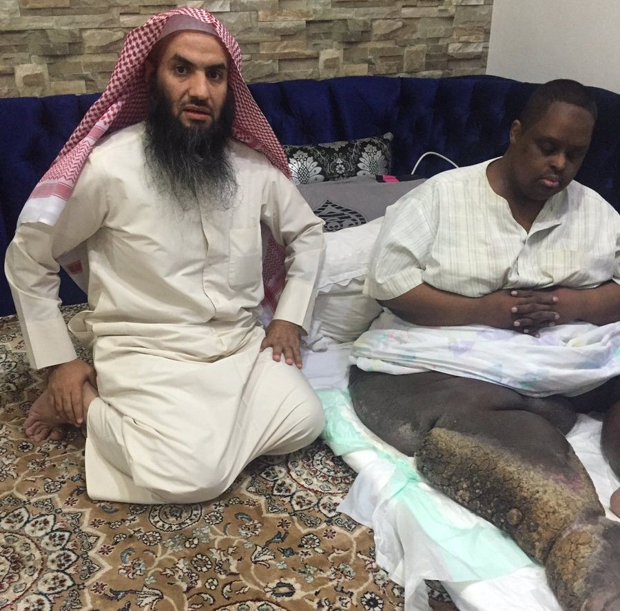 سعودي يعاني من مرض نادر يستنفر تويتر لعلاجه محمد العنزي (1)