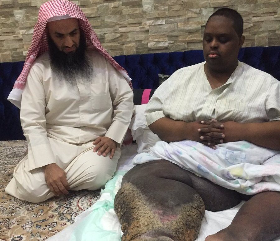 سعودي يعاني من مرض نادر يستنفر تويتر لعلاجه