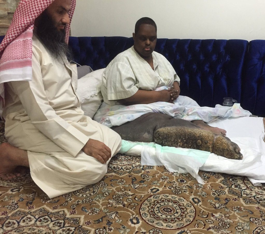 سعودي يعاني من مرض نادر يستنفر تويتر لعلاجه محمد العنزي (3)
