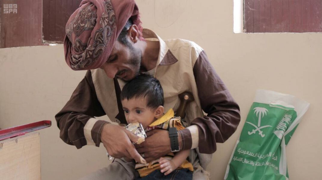 مركز الملك سلمان للإغاثة يواصل علاج سوء التغذية في مديرية نصاب بشبوة