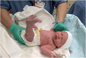 دراسة: الولادة القيصرية تؤثر سلبًا على تطور البشر