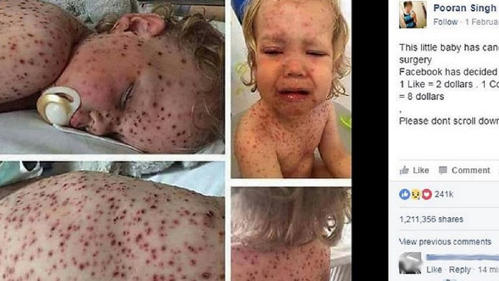 فيسبوك يحذف مستخدمَيْن نشرا صورًا تدعي إصابة طفل بالسرطان