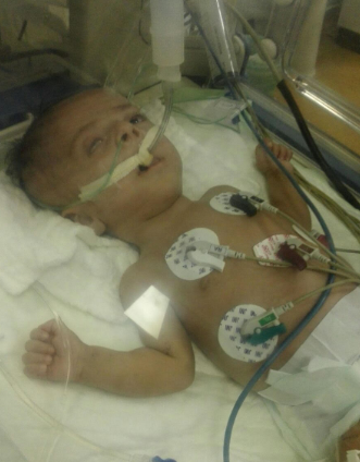 فهد .. طفل يصارع الموت بمستشفى الأطفال بـ #الطائف .. أنقذوه