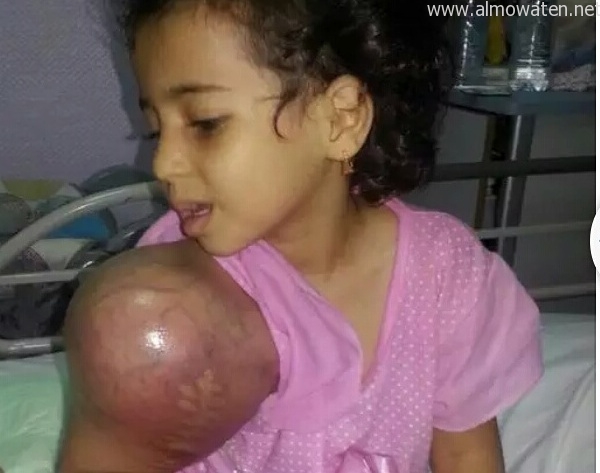 رسالة استغاثة من اليمني عبدالملك الشعيبي عبر “المواطن” لإنقاذ طفلتيه