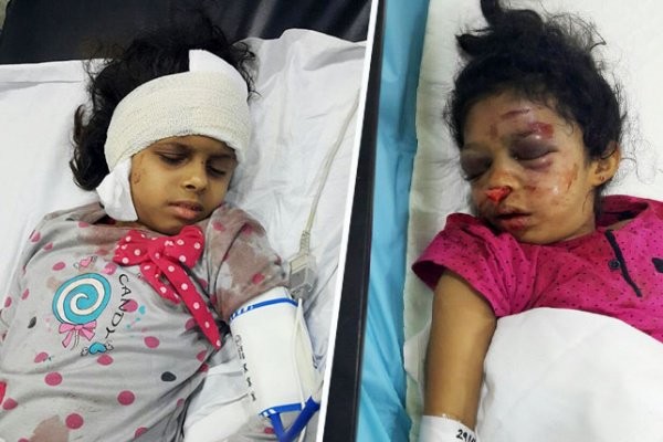 تفاصيل اعتداء خادمة إثيوبية  على طفلتين وأمهما في #جازان