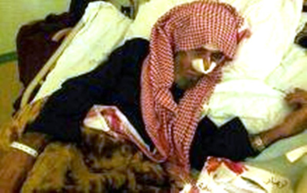 مبارك يعجز عن علاج والديه وأشقائه والحزن يحول حياته إلى جحيم