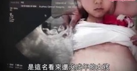 شاهد.. فتاة عمرها 12 عاماً حامِل في الصين