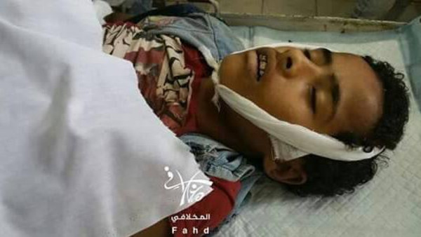 قناصة الحوثي تغتال البراءة في تعز.. و5 مجازر مدنية خلال يناير