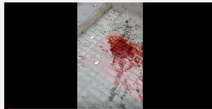 بالفيديو: طالب حوثي يلهو بقنبلة فتقتل وتصيب 15 بمدرسة في #صنعاء