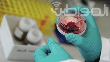 (4) وفيات و(6) إصابات بـ”كورونا” خلال (24) ساعة