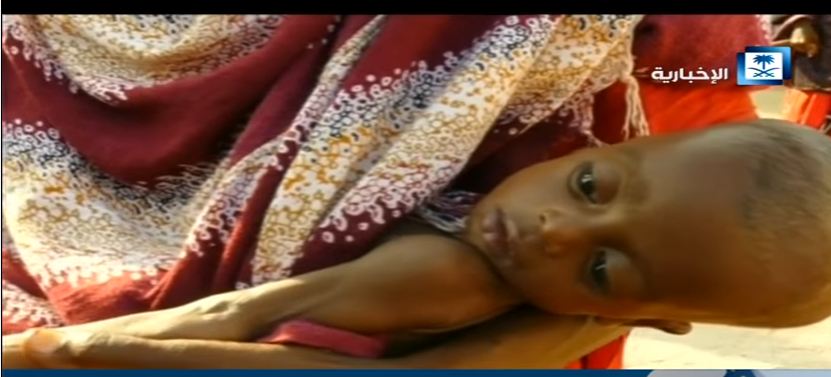 بالفيديو.. وفاة 100 صومالي بسبب المجاعة خلال يومين