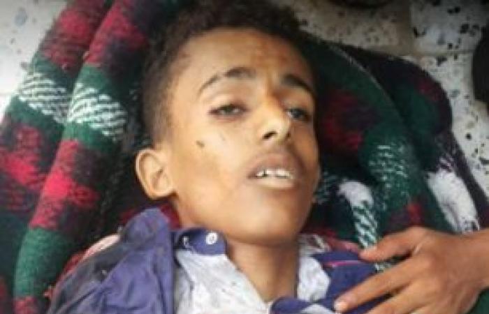 وزارة الإعلام اليمنية: مجزرة الصحفيين في تعز جريمة حرب